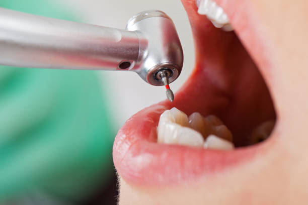 Best Emergency Denture Repair in South Pasadena, FL